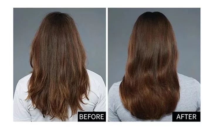 头上的螨虫用什么方法消除,头上又油又痒