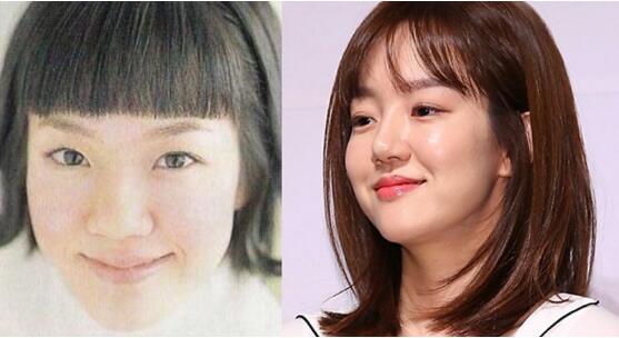 韩国明星谈整容,韩国明星整容失败