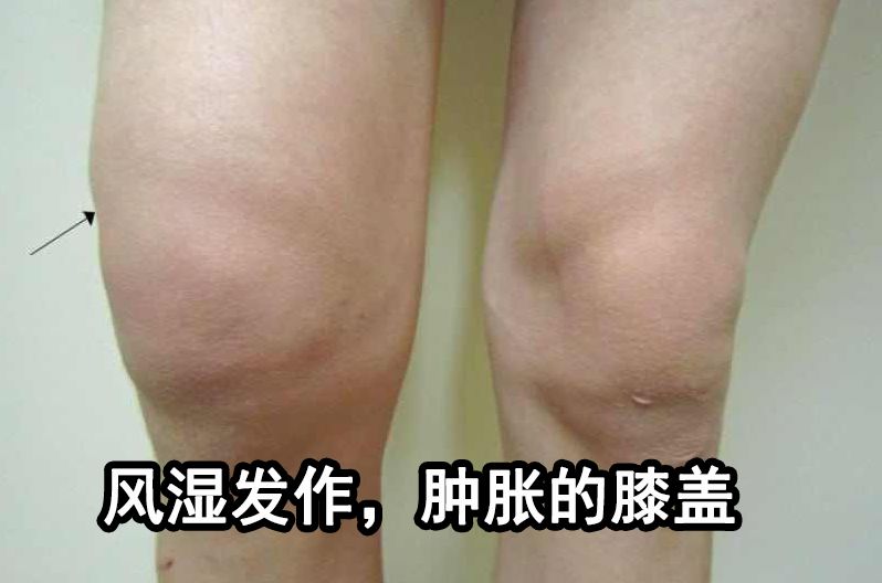 「周三爆款返场」你们要的酸痛大师台湾一条根,来喽