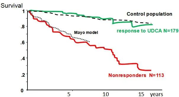 APASL2020|贾继东教授:熊去氧胆酸难治性PBC患者的管理