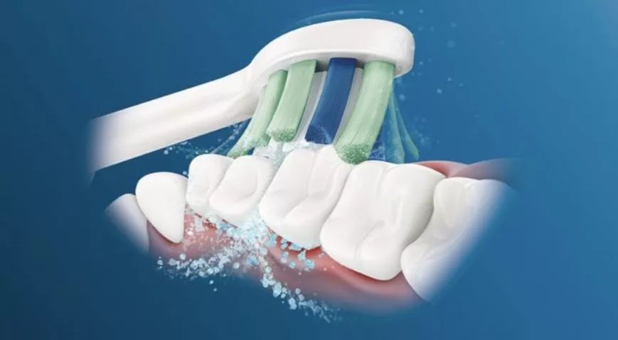 飞利浦和usmile电动牙刷哪个更好,飞利浦电动牙刷性价比高的一款