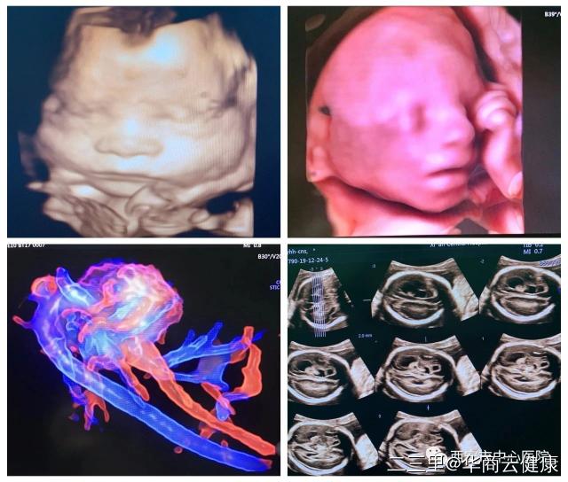 产检b超169mm是什么意思,产检b超做多了对胎儿有影响吗