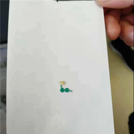 惊险！唐山妇幼耳鼻喉科一天收治7例异物患者