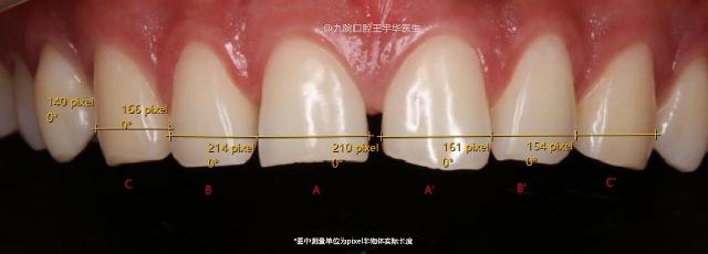 门牙中间有缝是否影响运势,门牙开缝是不是很丑