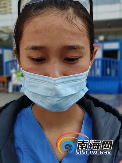 开水烫、酒精泡……残破的眼镜是海南驰援湖北90后护士吴强的特殊“军功章”