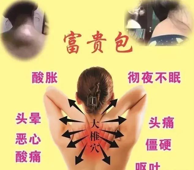 一样的体重怎么比去年更胖呢,同样体重看起来比别人胖怎么办