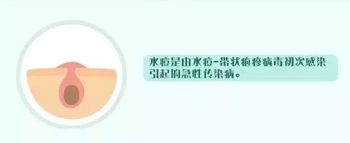 关于水痘高发期的注意事项,水痘进入高发季注意事项