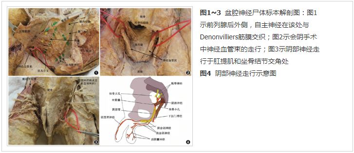 低位直肠癌mdt,低位直肠癌症状有哪些