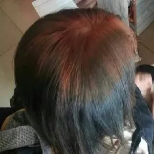 千万不要自己在家染发,买染发剂自己在家染发