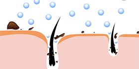 脸上痘痘反反复复毛孔大,痘痘黑头粉刺出油