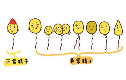 重度少弱畸形精子症能治愈吗,严重少弱畸形精子症