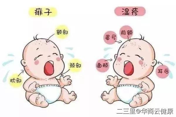 湿疹护理方法,如何护理宝宝湿疹的方法视频