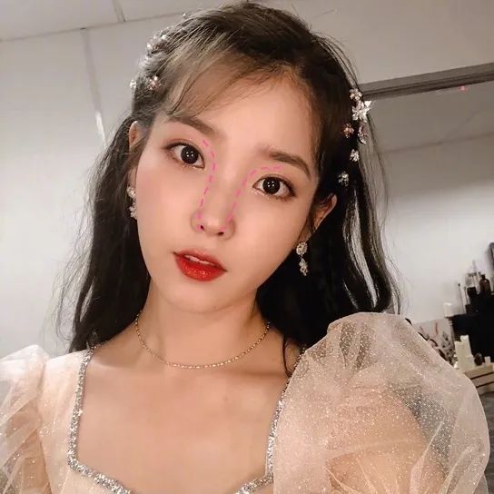 做了鼻镜后遗症,做了鼻基底都后悔吗