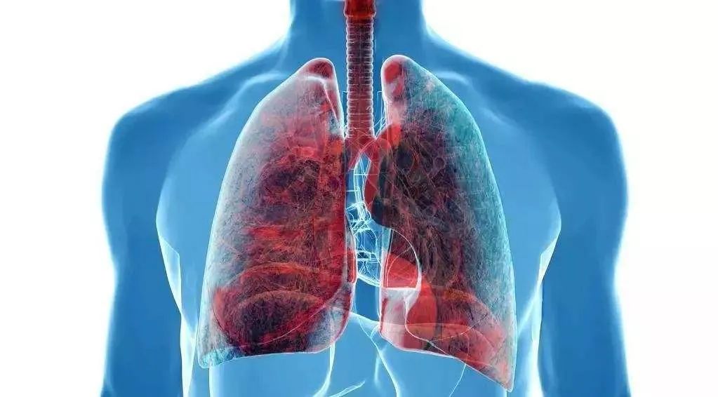 肺癌临床诊疗指南2023,全国100家肺癌防治中心