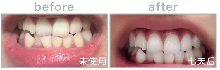 英国人被嘲几十年的黄牙口臭，终于靠它洗白了