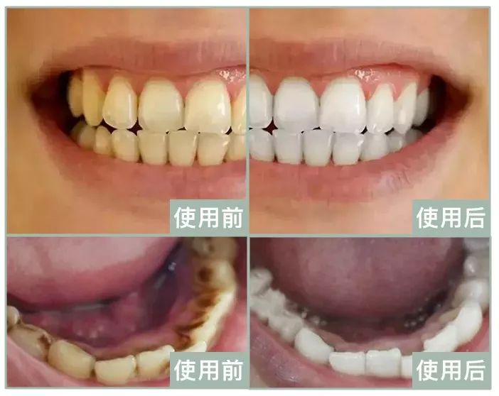 英国人被嘲几十年的黄牙口臭，终于靠它洗白了