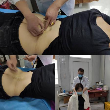 辰溪县中医院康复科,泾川县中医院康复科