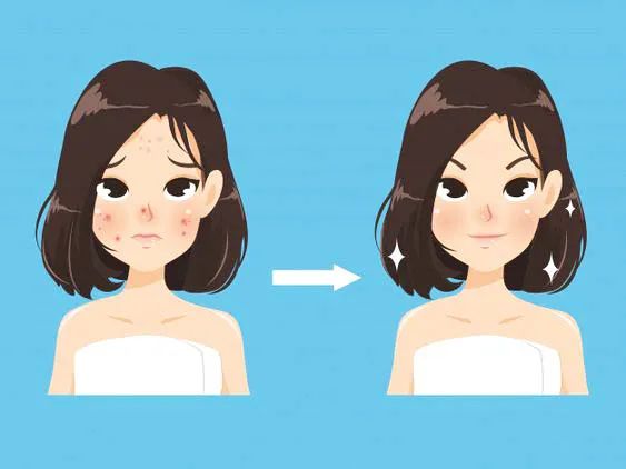 为什么戴上口罩会闷痘,为什么戴口罩就长痘