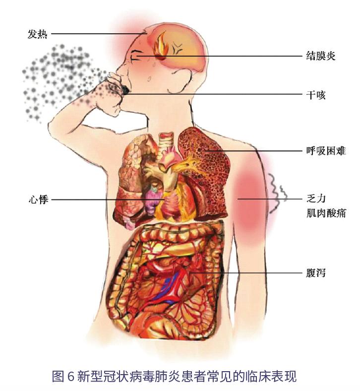 新冠状病毒留学生有话说,美国留学生抗击新型冠状病毒
