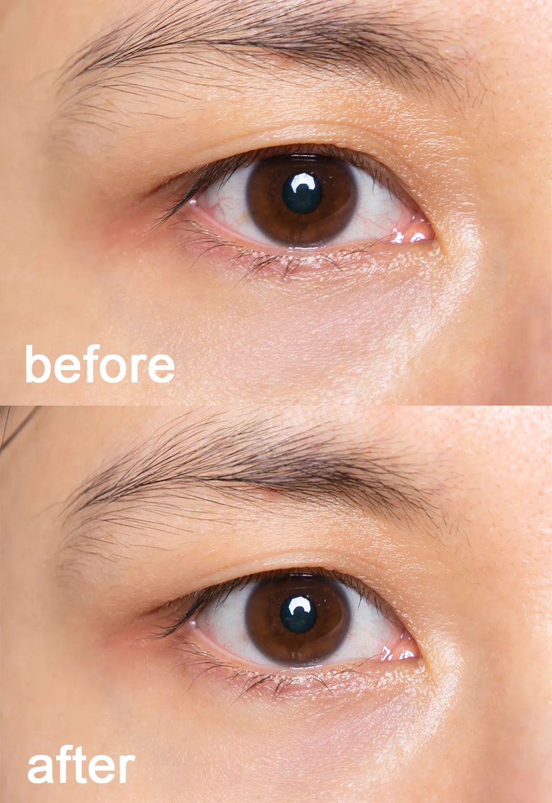 所有使眼睛变大的方法,让眼睛变大方法