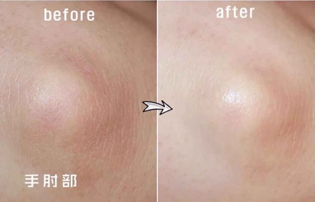 美脚神器磨脚死皮,美脚神器自动磨脚器去死皮老茧