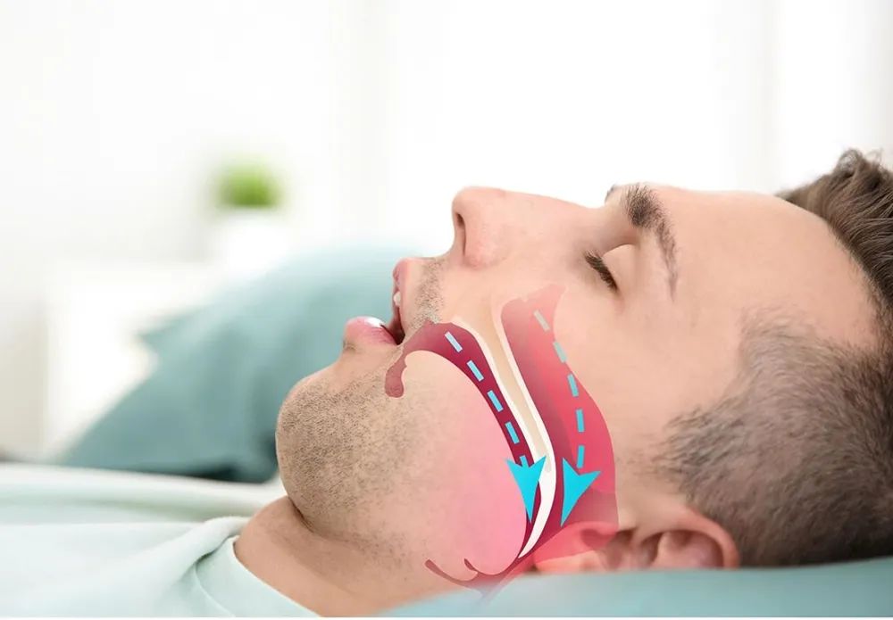 为什么我这么瘦,为什么我那么瘦了还打鼾