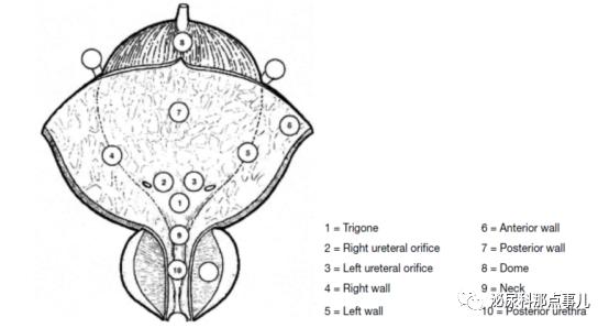 eau2020,肌层浸润性膀胱癌欧美