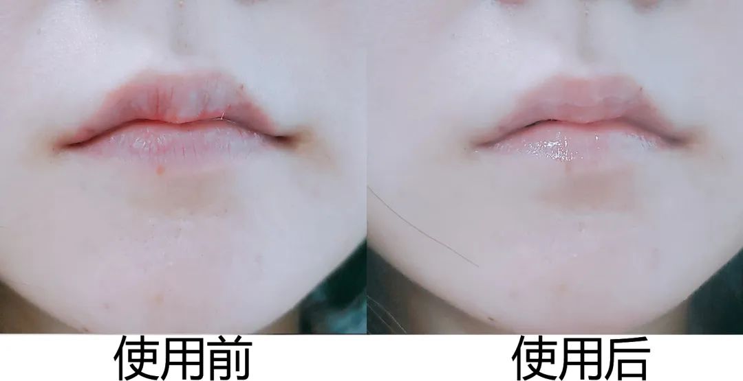 拒绝皮肤干裂带来的尴尬,唇部保养tips教程