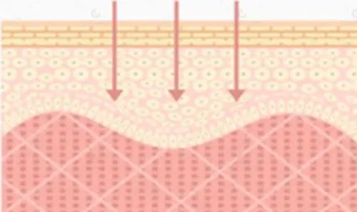拒绝皮肤干裂带来的尴尬,唇部保养tips教程