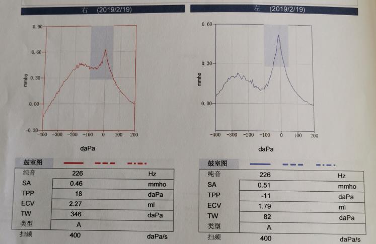 复发性前庭病如何治疗,双侧前庭病治疗