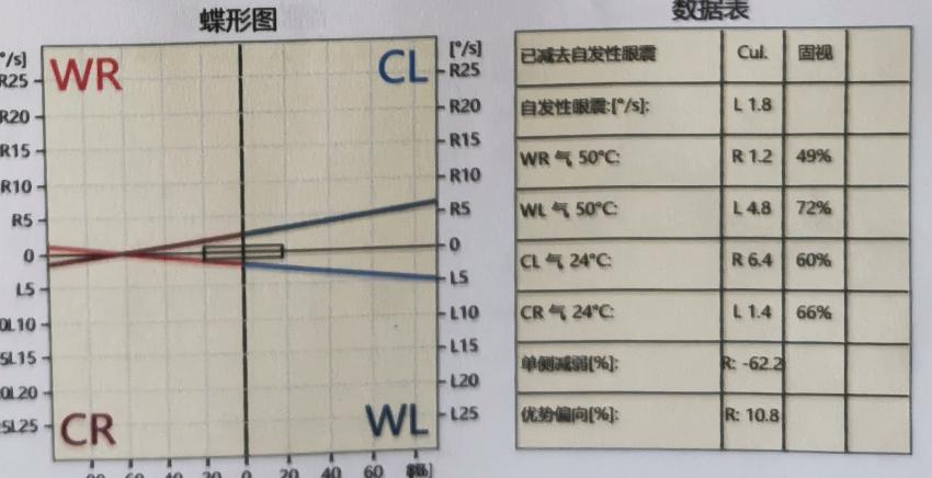 复发性前庭病如何治疗,双侧前庭病治疗