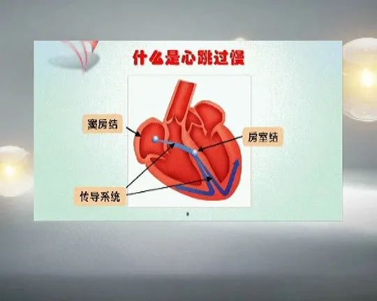 心率过低有什么危险,心率过低的人需要注意什么