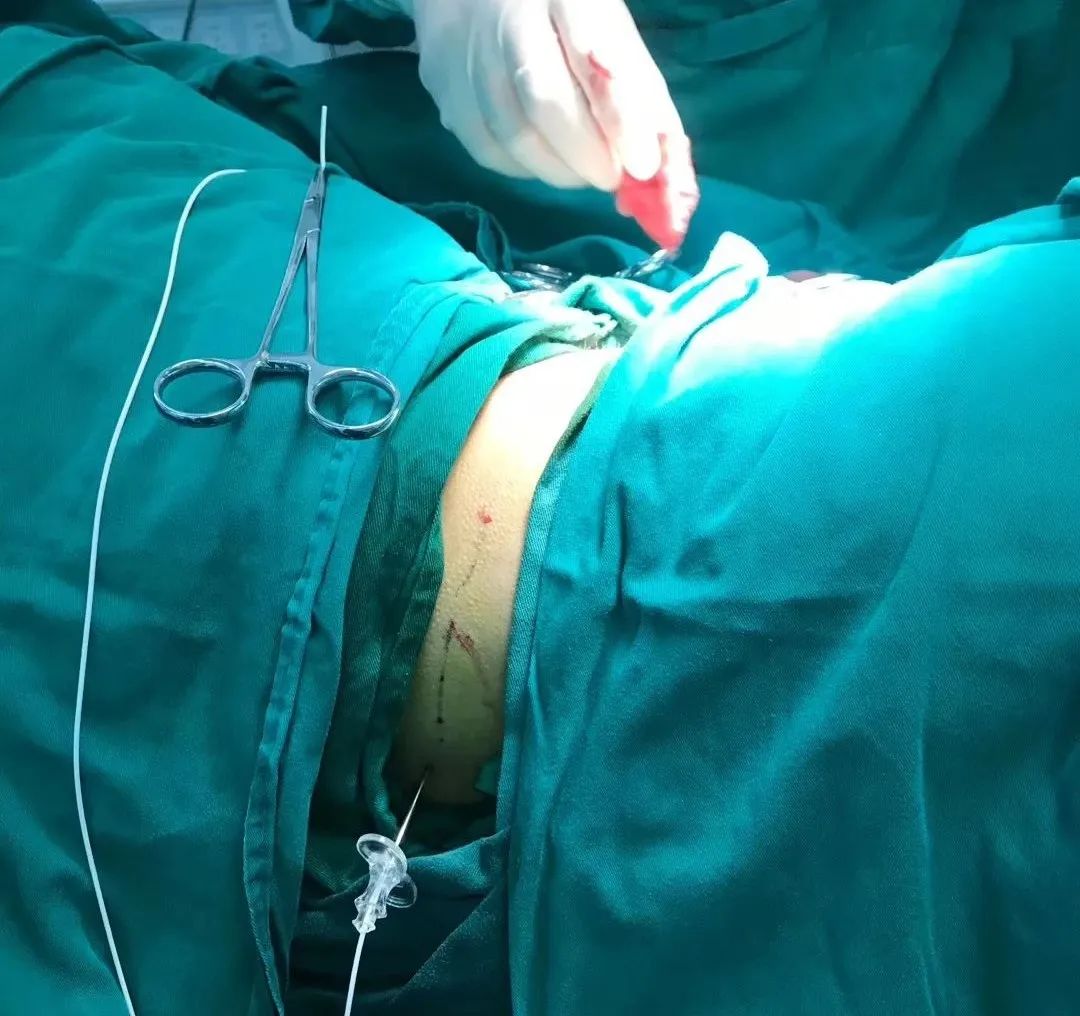 癌症吃止痛药都没用了还能活多久,癌症病人吃止疼药不管用怎么办