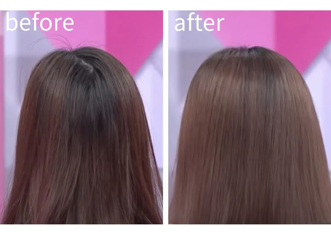 发量暴增的5个方法男士,怎么让发量暴增