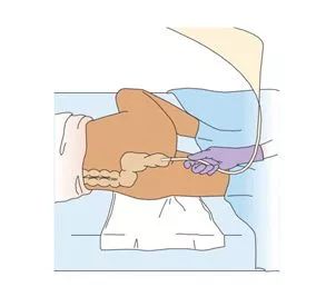 各类灌肠的区别笔记,灌肠科普解说