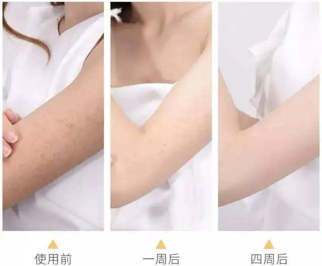 深扒明星美白抗衰秘籍！比防晒管用1000倍！4周逆袭成白皮，悄悄瘦掉8斤