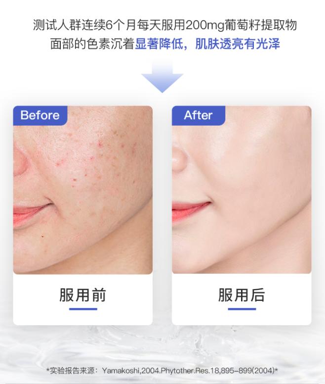 深扒明星美白抗衰秘籍！比防晒管用1000倍！4周逆袭成白皮，悄悄瘦掉8斤