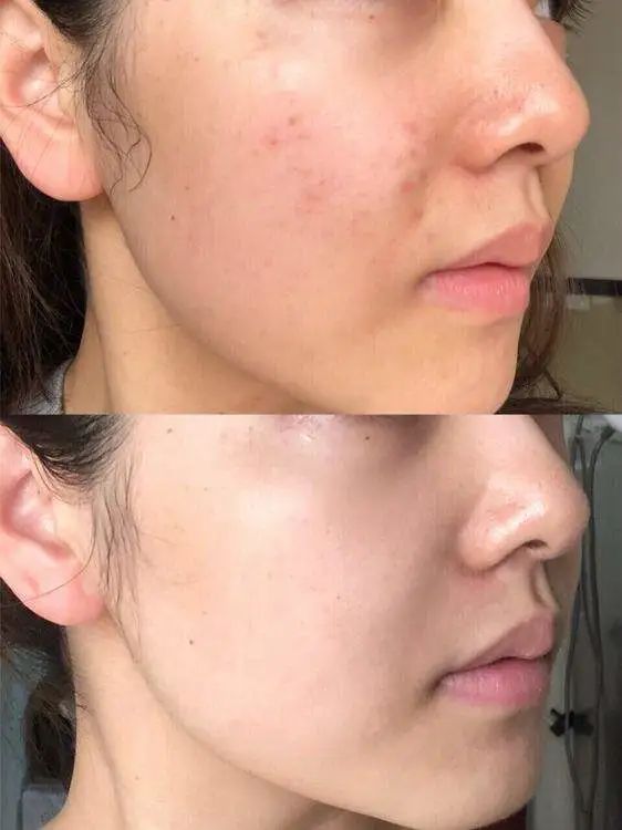 深扒明星美白抗衰秘籍！比防晒管用1000倍！4周逆袭成白皮，悄悄瘦掉8斤