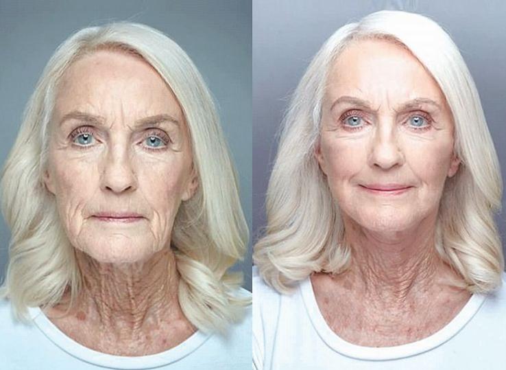 深扒明星美白抗衰秘籍！比防晒管用1000倍！4周逆袭成白皮，悄悄瘦掉8斤