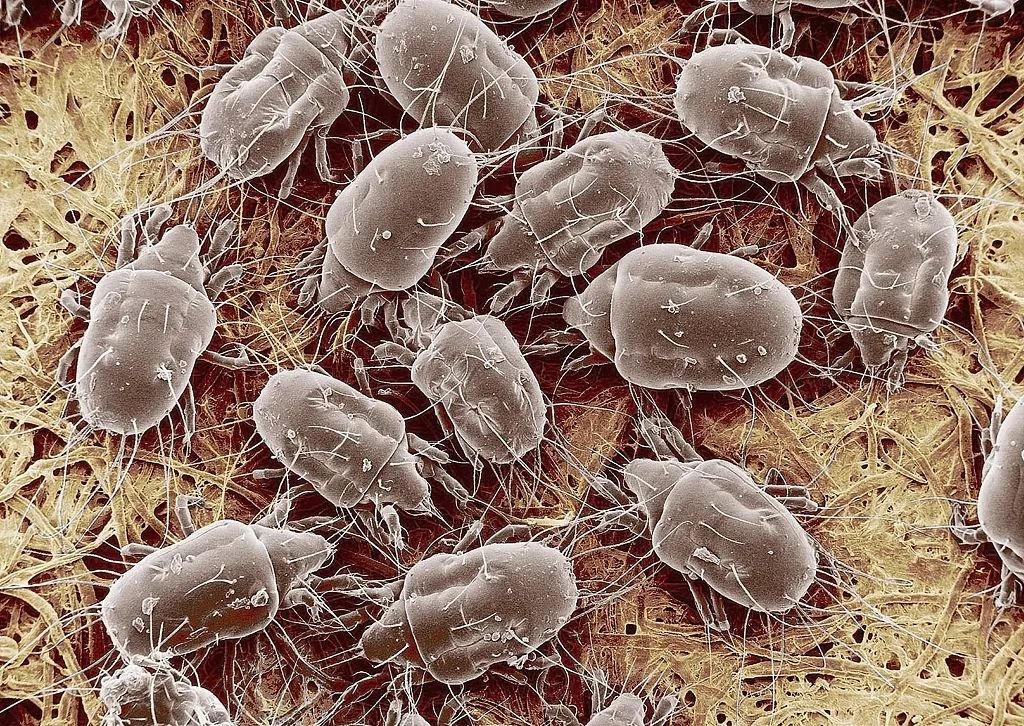 男子每天起床连打十几个喷嚏，最近很多人都同样中招，千万留意