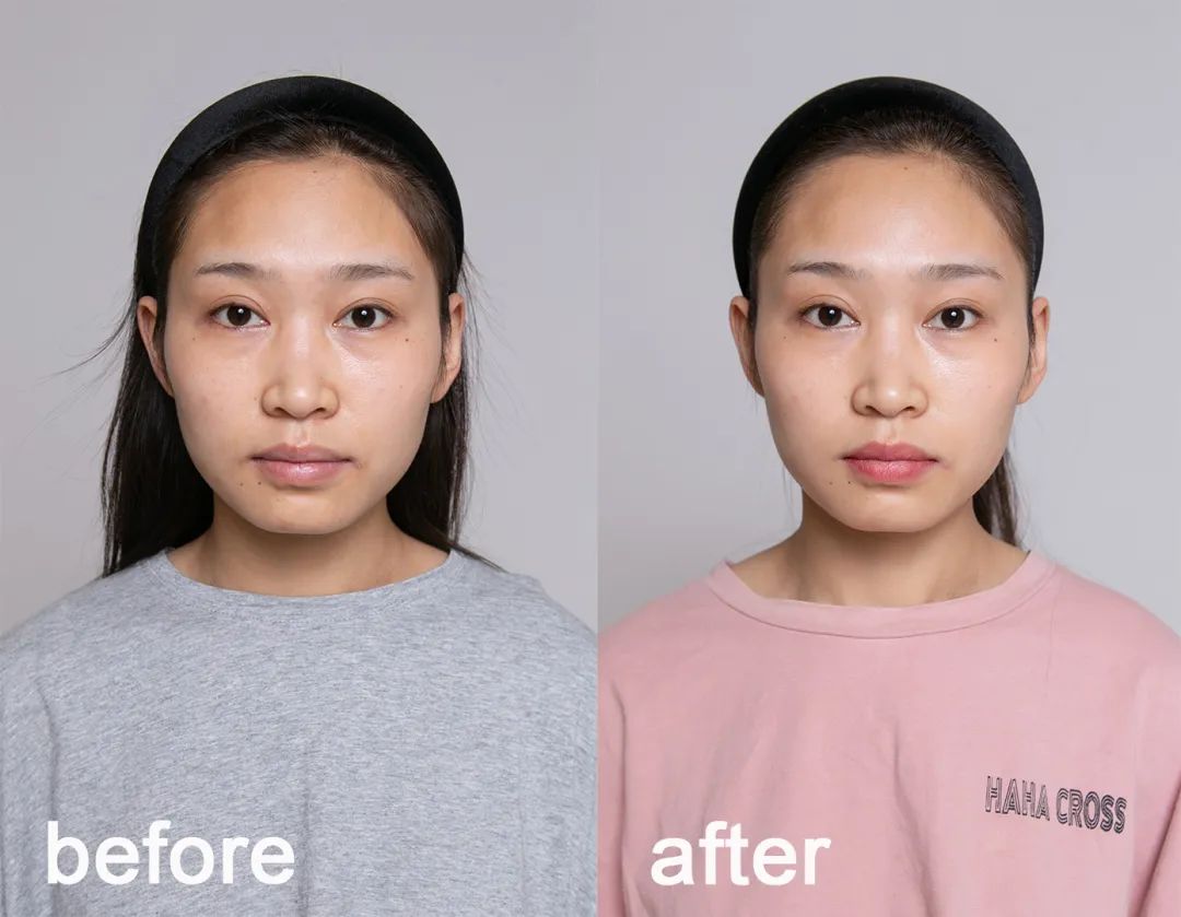 祛黄淡斑美白精华推荐,377美白淡斑精华哪款效果最好