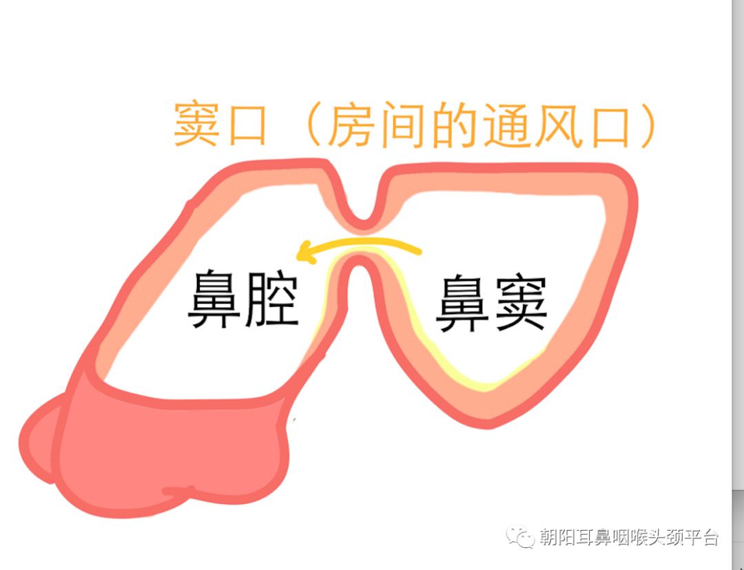 副鼻窦炎头痛怎么办,急性鼻窦炎头痛牙痛吃什么药