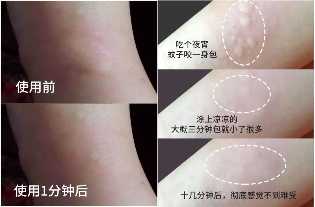 长小水泡很痒用什么中药,皮肤止痒起包用哪个药膏