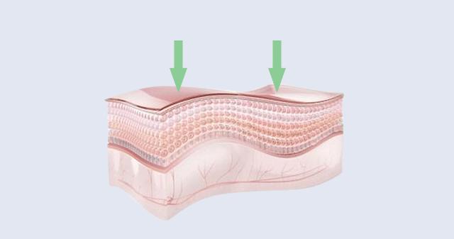 长小水泡很痒用什么中药,皮肤止痒起包用哪个药膏