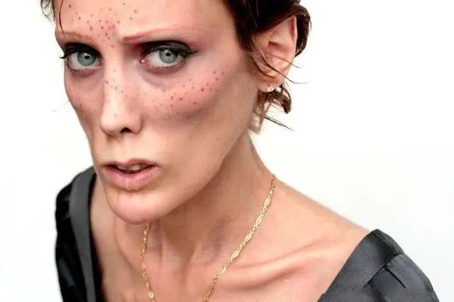 轻断食会得厌食症还是暴食症,厌食症暴食症前期有什么预兆