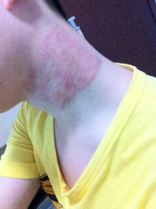 「周三爆款返场」你们要的酸痛大师台湾一条根,来喽