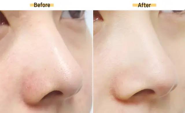 超火收毛孔*法大**！城野医生+蒂佳婷完美cp，美好价格让肌肤瞬间光滑