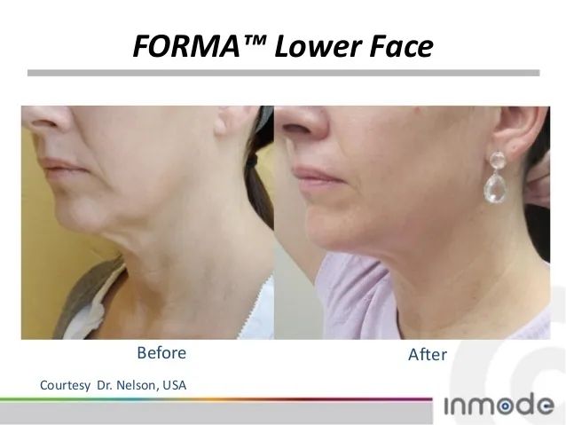 听说戴着口罩,集美们都偷偷在DO脸?