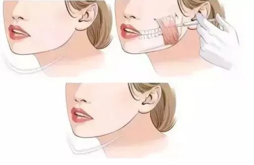 听说戴着口罩,集美们都偷偷在DO脸?