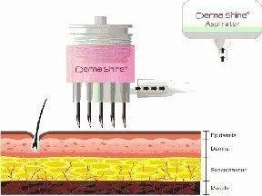 听说戴着口罩,集美们都偷偷在DO脸?